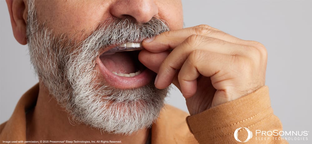 Sleep Apnea Appliance